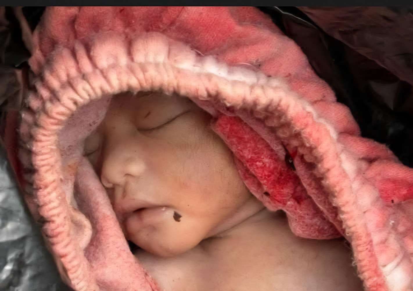 Innalillahi, Bayi Perempuan yang Ditemukan di Sungai Lilin Meninggal Dunia
