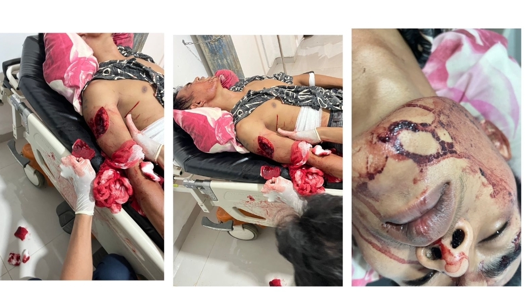 Niat Jadi Penyelamat, Pemuda di Muaradua Malah Jadi Korban Serangan Pedang