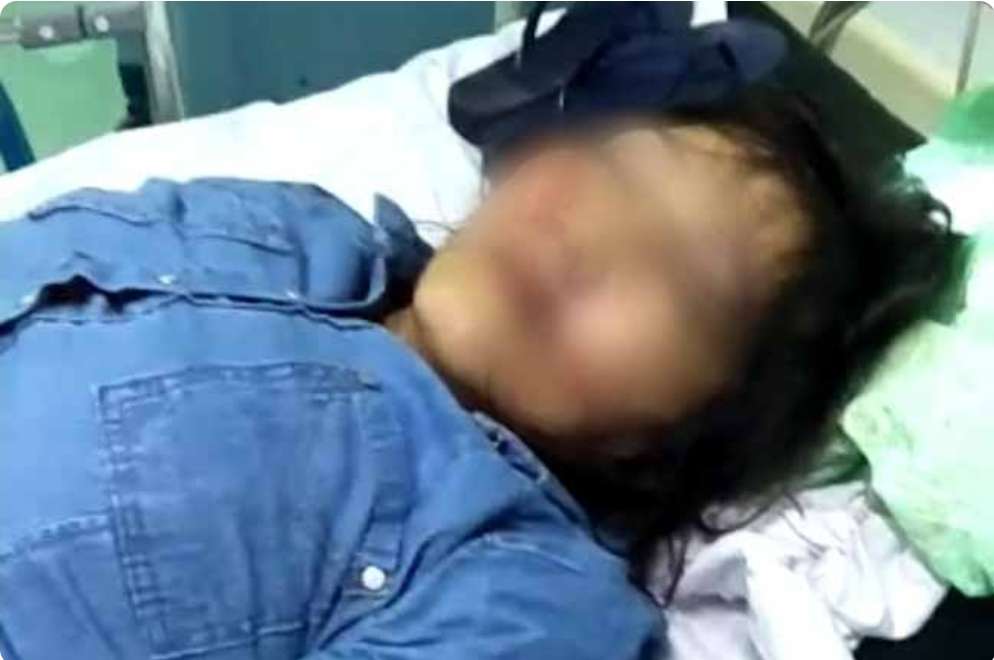 Tragis, Seorang Wanita di Palembang Diduga Korban Jambret, Ditemukan Tidak Sadarkan Diri