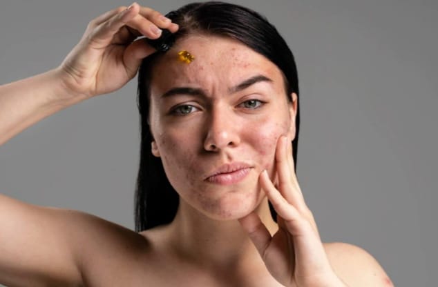 Waspada, Ini 6 Dampak Buruk Penggunaan Merkuri untuk Make up dan Skincare