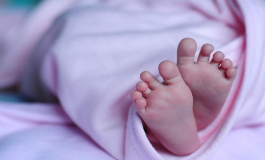 Heboh Bayi Lahir Dengan Kelainan Langka di Muba, Ini Penjelasan Pihak RSUD Sekayu 