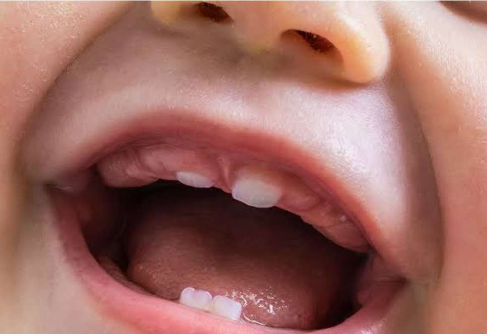 Bayi Sering Panas Saat Tumbuh Gigi, Ini Penjelasannya