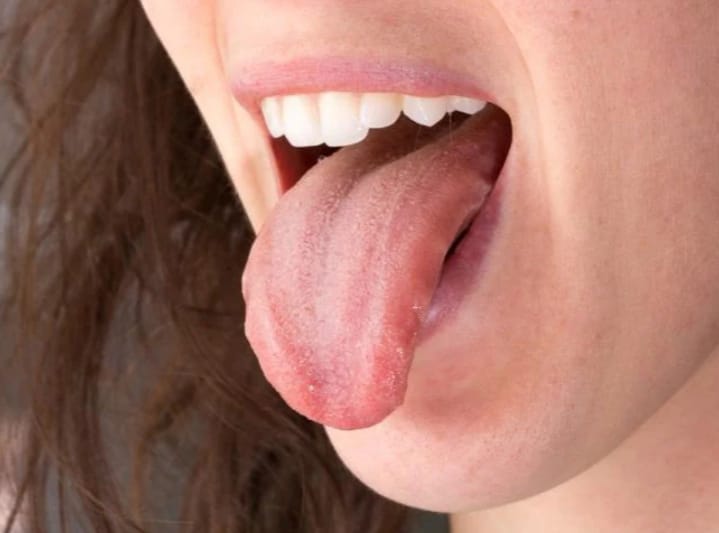 Ini Penyebab Mulut Terasa Pahit Saat Puasa dan Cara Mengatasinya