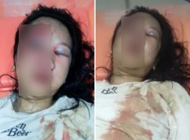 Empat Hari Tak Pulang, Anak Perempuan di Lubuklinggau Jadi Korban Penganiayaan