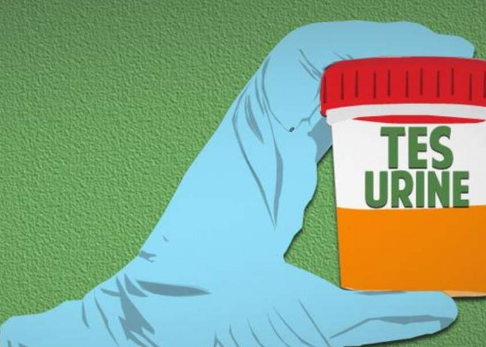 Polisi Tes Urine Sopir Penabrak Pasutri Hingga Meninggal di Banyuasin, Hasilnya Positif