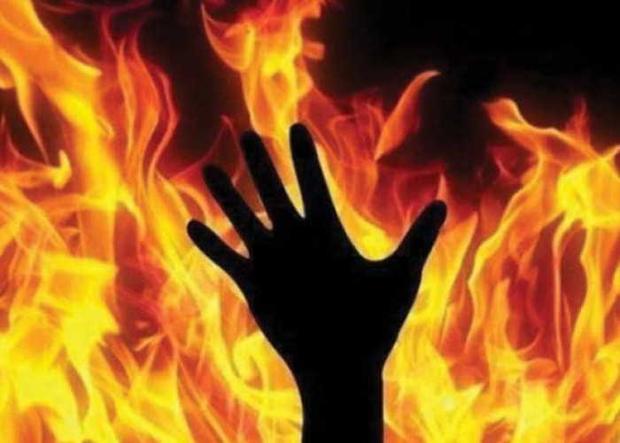 Seorang Santri Nyaris Meregang Nyawa, Diduga Karena Dibakar Oleh Seniornya