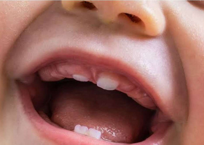 Bayi Sering Panas Saat Tumbuh Gigi, Ini Penjelasannya