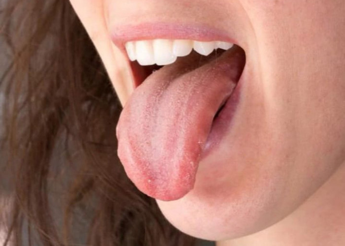 Ini Penyebab Mulut Terasa Pahit Saat Puasa dan Cara Mengatasinya