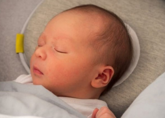 Mom, Ini Penyebab Kepala Bayi Peyang dan Cara Mencegahnya