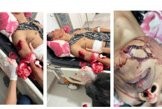 Niat Jadi Penyelamat, Pemuda di Muaradua Malah Jadi Korban Serangan Pedang